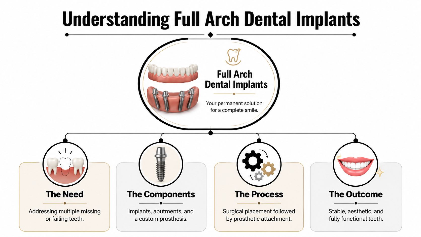An infographic explaining the full arch dental implant procedure, components, necessity, and final aesthetic results.
