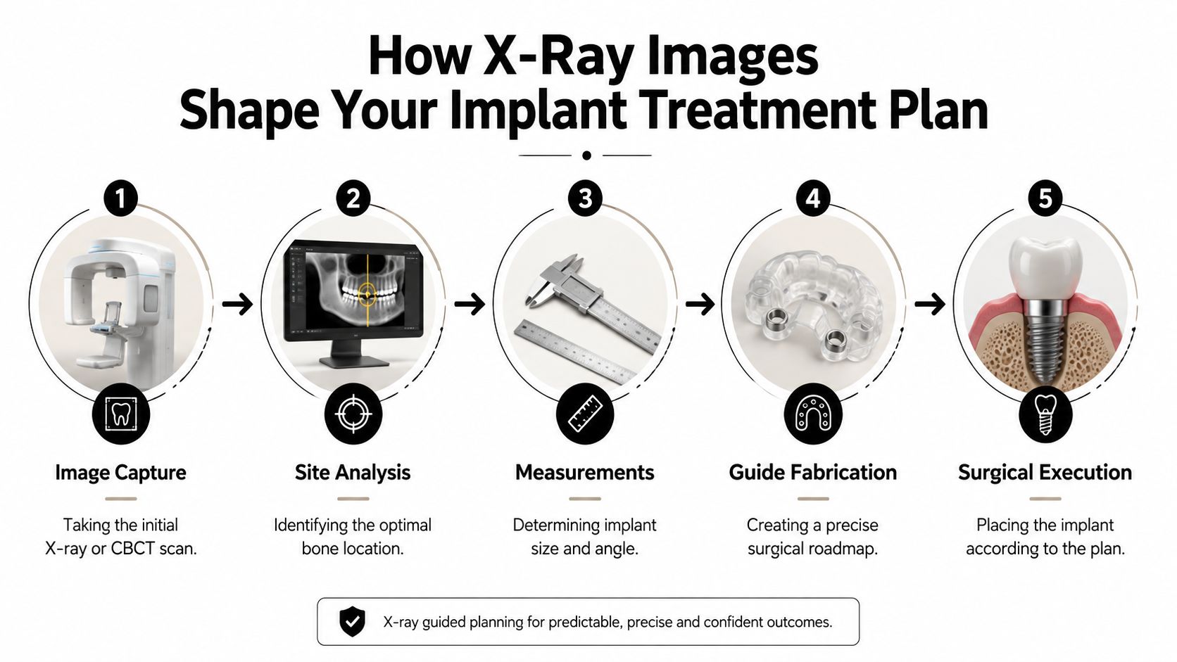 A five-step infographic showing how dental X-rays and CBCT scans are used for precise implant treatment planning.