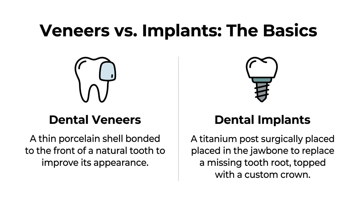 An infographic comparing dental veneers and dental implants with illustrations and brief definitions for each procedure.