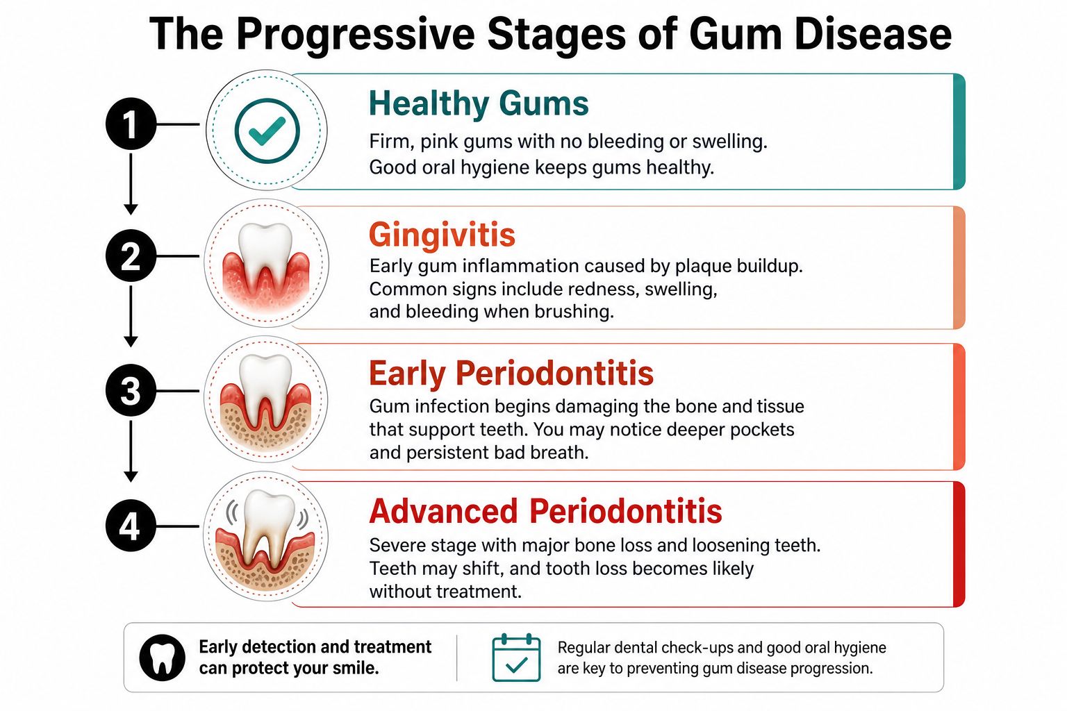 A chart detailing the four progressive stages of gum disease from healthy gums to advanced periodontitis.