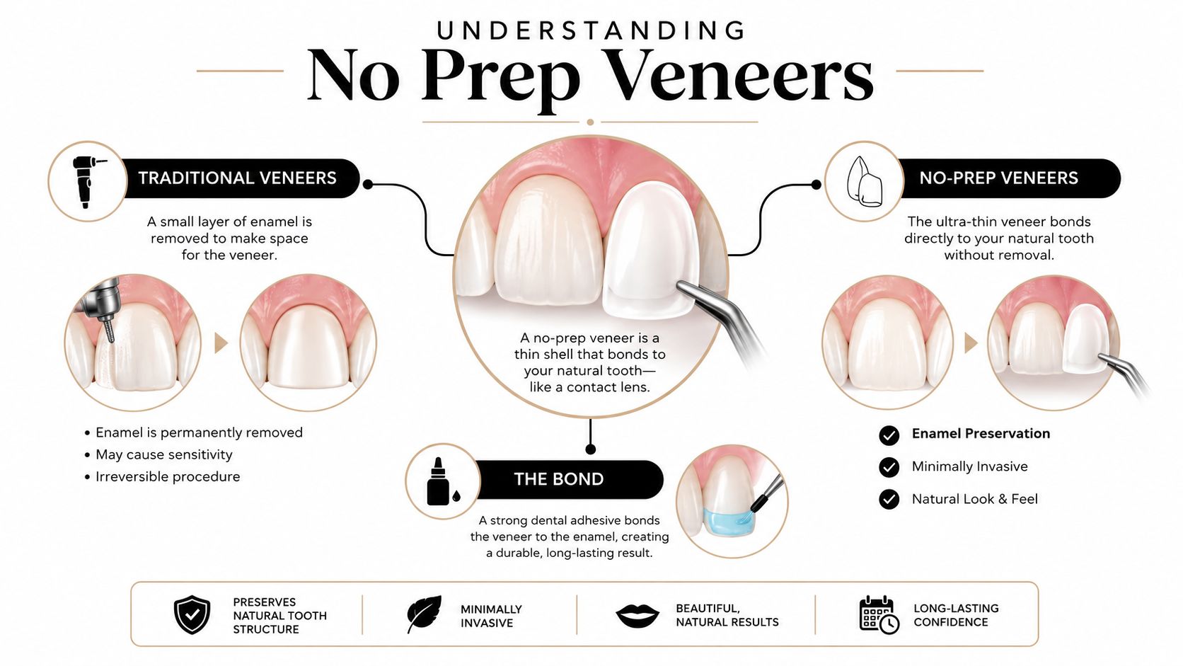 An infographic showing the difference between traditional veneers that remove enamel and no-prep veneers that preserve it.