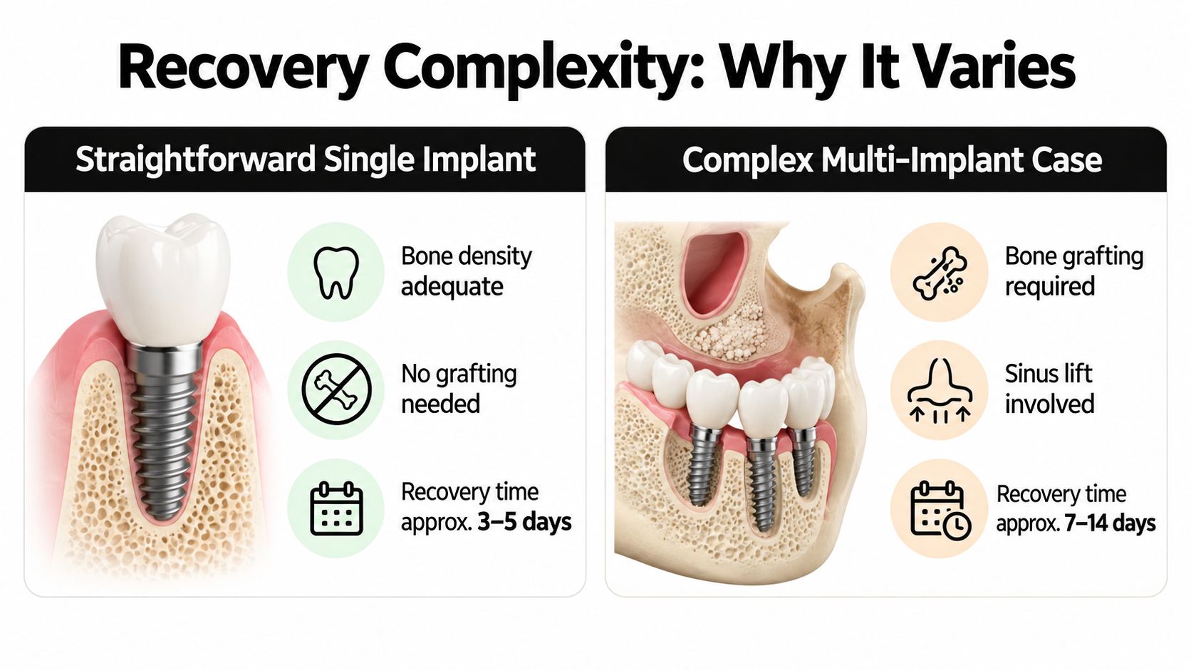 A comparison chart showing factors affecting recovery time for single versus complex multi-implant dental procedures.